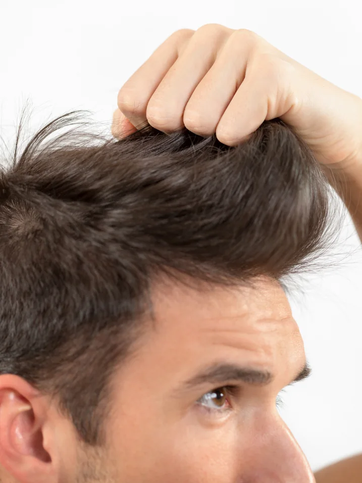 Man examining thinning hair at the crown